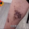 真实记录缅北大逃亡！缅北惊魂