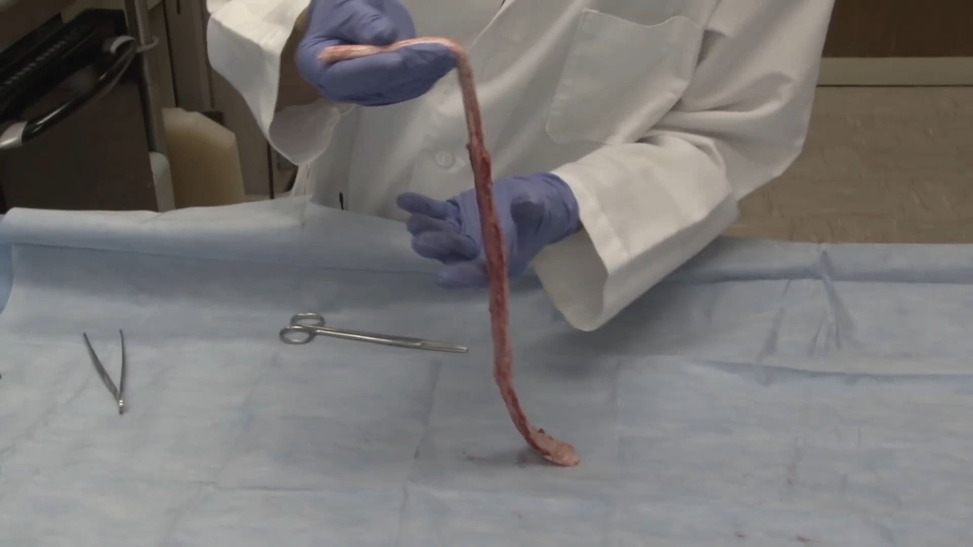 你的脊髓十分的脆弱