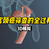 科普视频：宫颈癌筛查的全过程