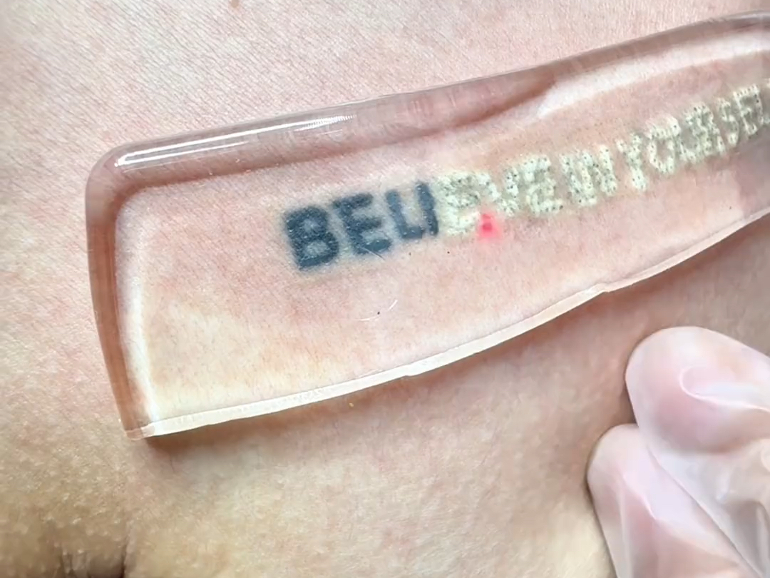 解压版清洗纹身