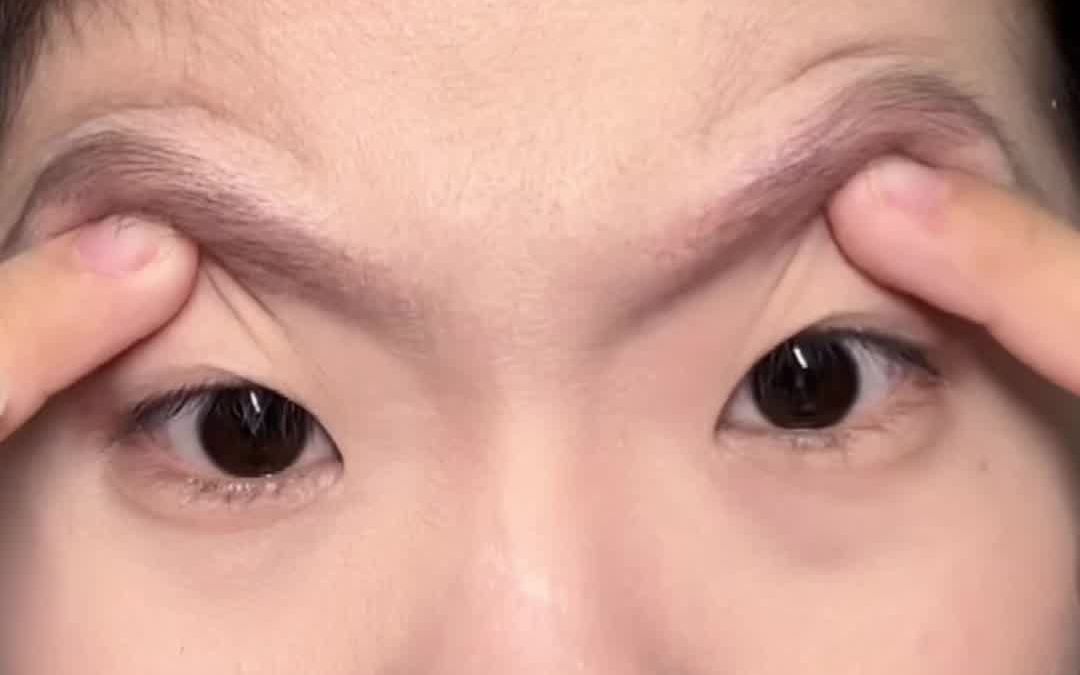 肿眼泡如何正确贴双眼皮，一个视频教会你！