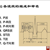 心电图原理及正常心电图