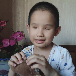 自闭症盲孩的父亲快崩溃了