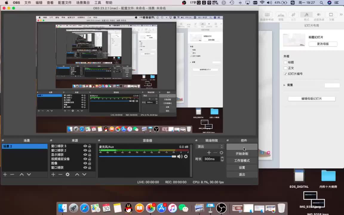 18 死髓变色牙的漂白