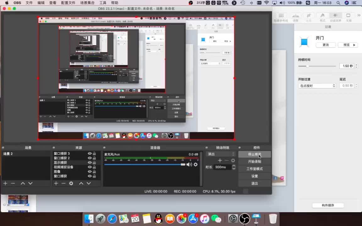 19 根管治疗后的直接复合树脂美学修复