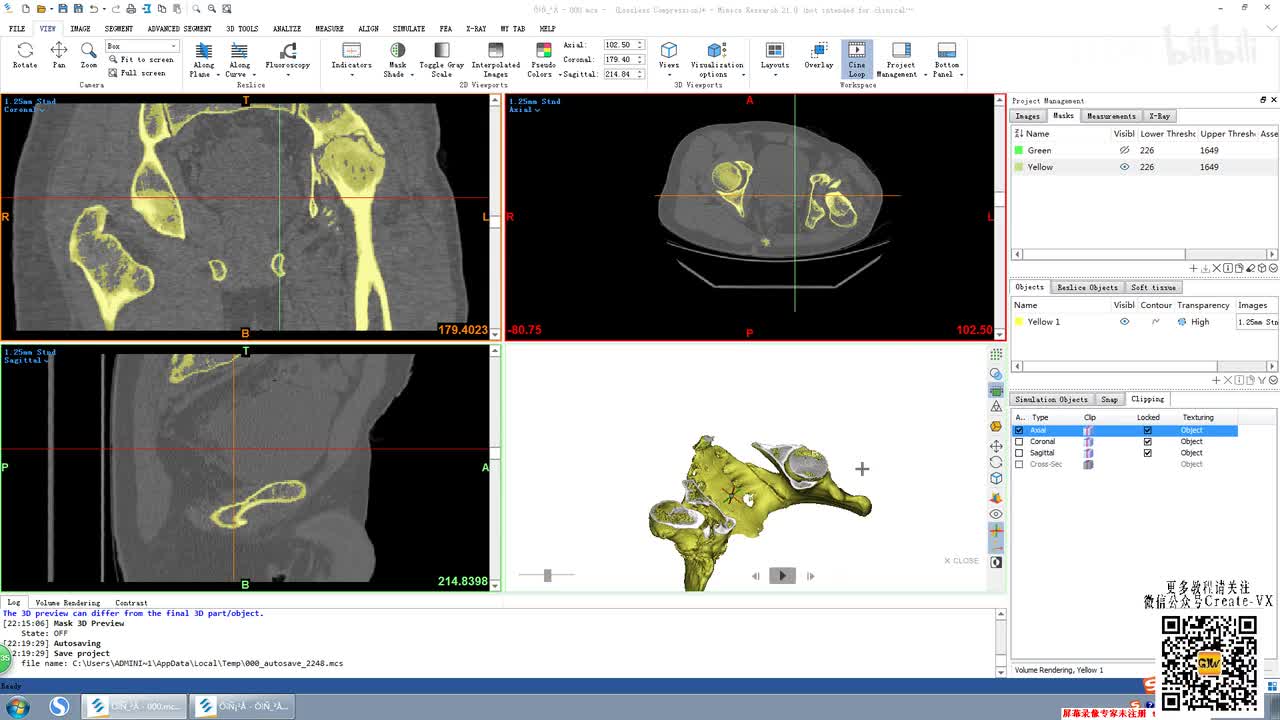 2-3、mimics21视图界面介绍讲解3