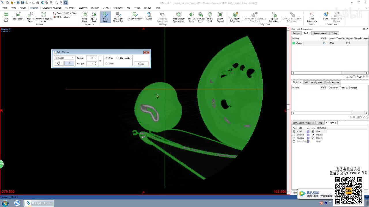 6-2、mimics21蒙版编辑（edit mask)2