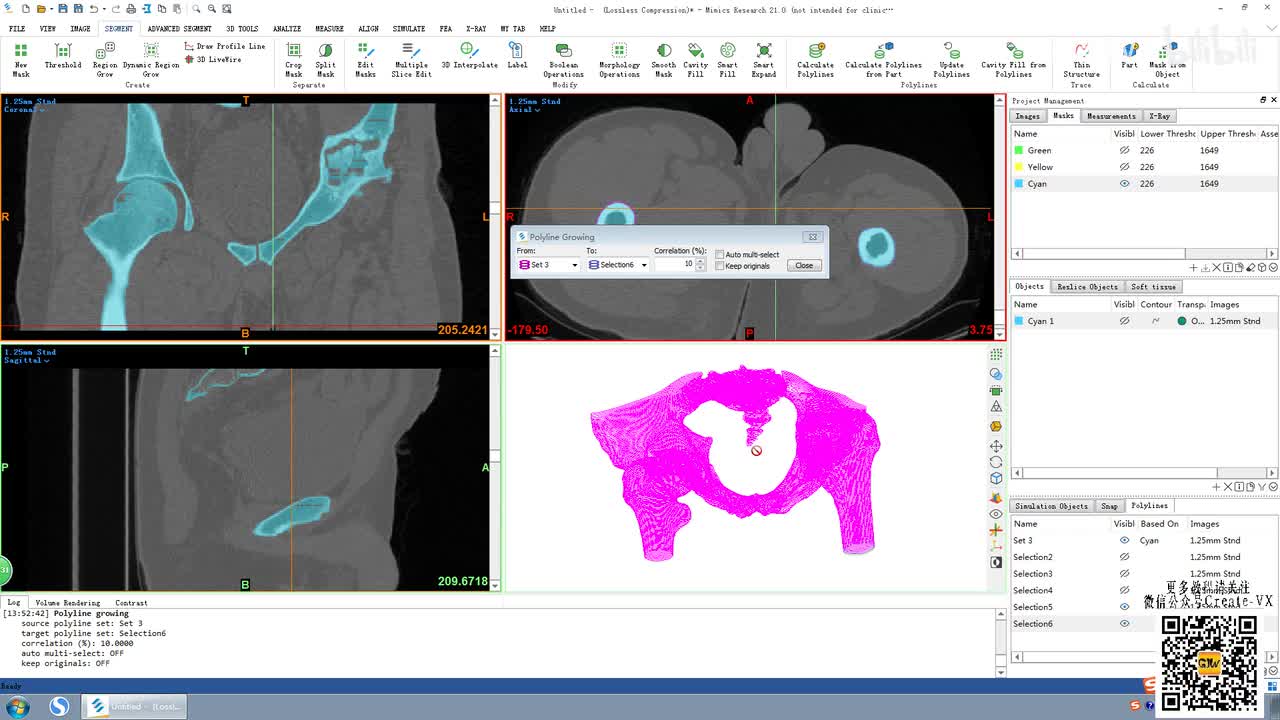 8-3、mimics21多义线(Polyline)菜单栏讲解3.mp4