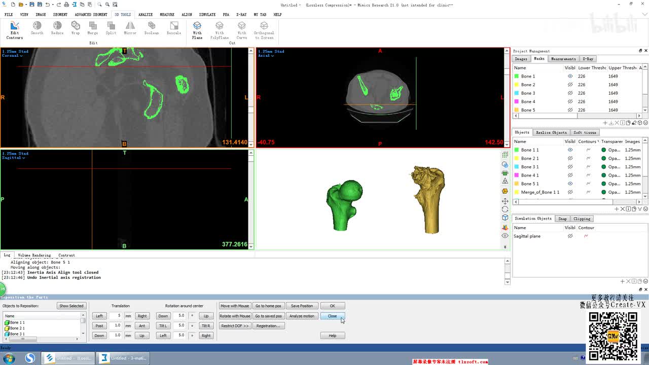 10-9、mimics21之3D tool工具栏 - edit contours命令讲解