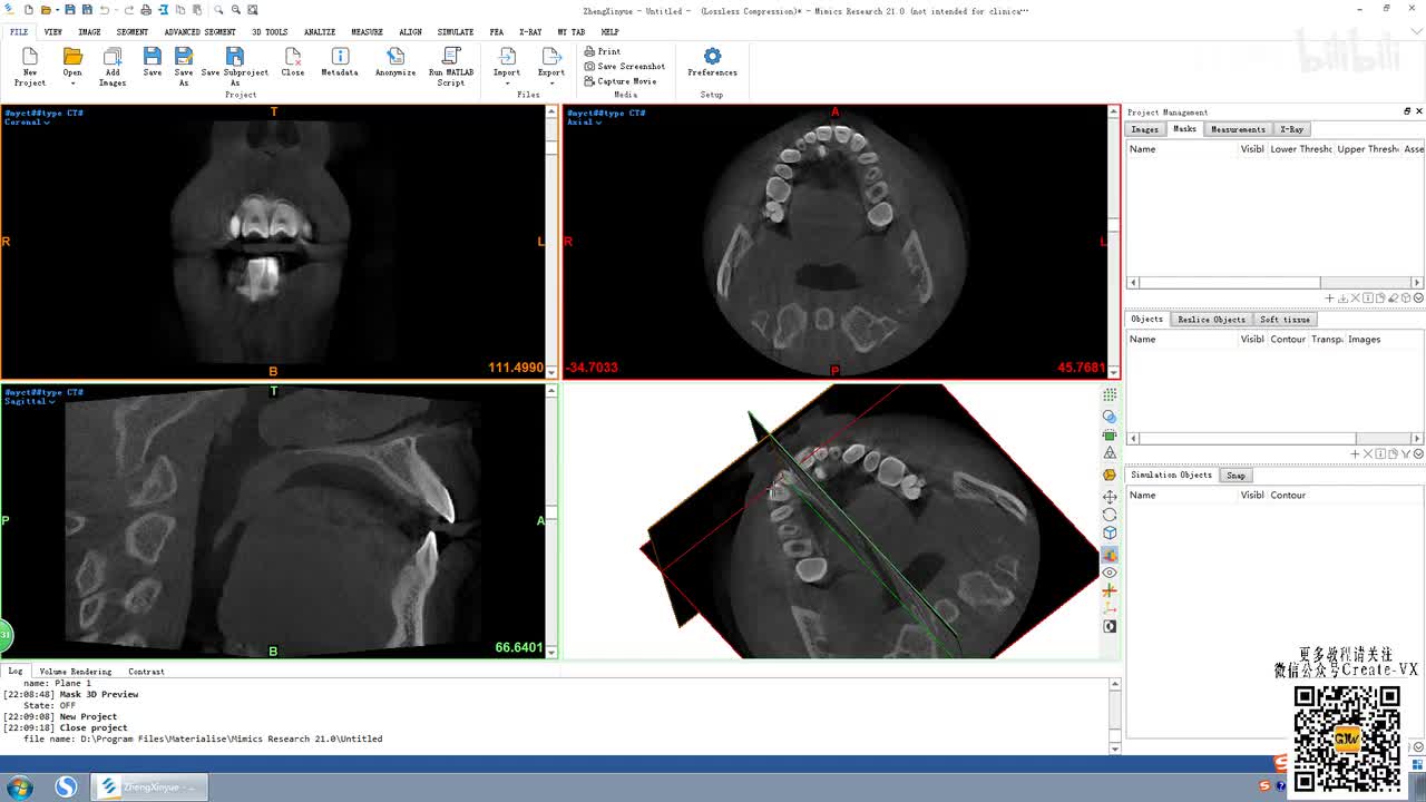 3-2、mimics21重切片（relice菜单）讲解2