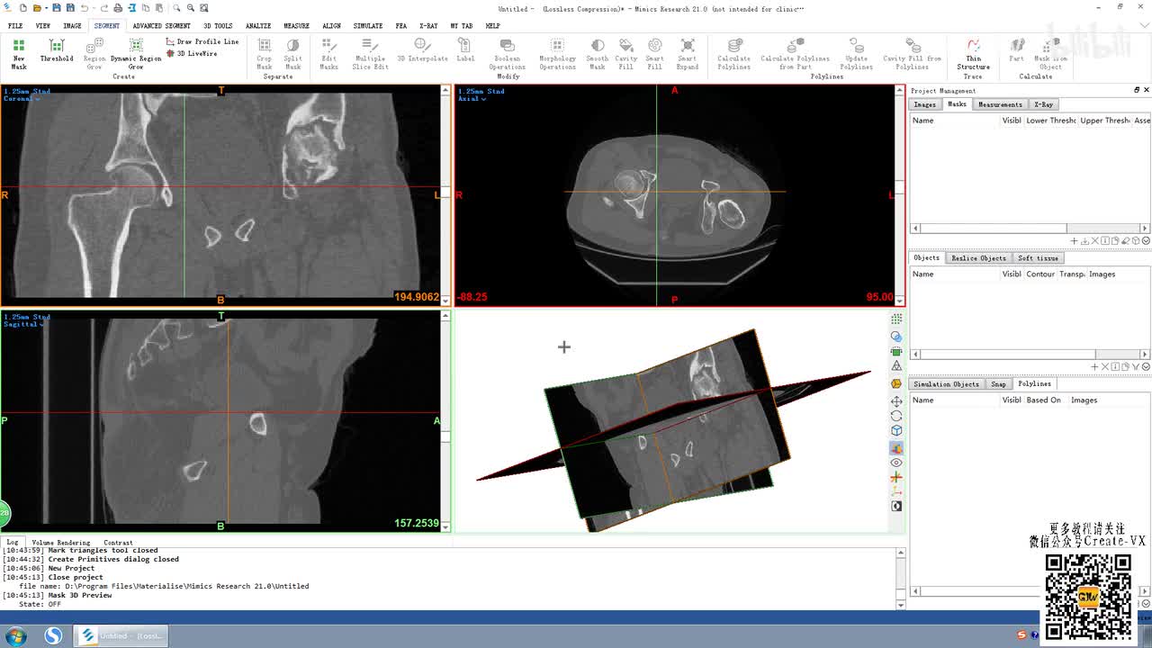 8-1、mimics21多义线(Polyline)菜单栏讲解1.mp4