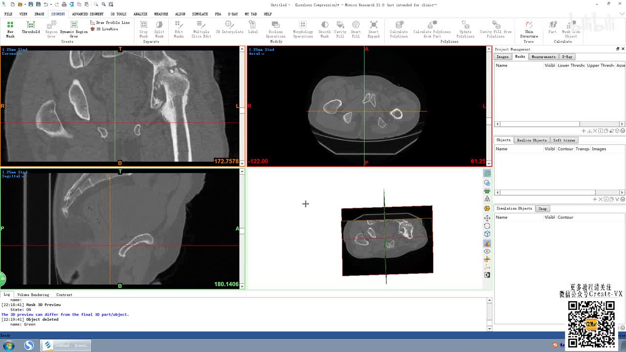 6-1、mimics21蒙版编辑（edit mask)1