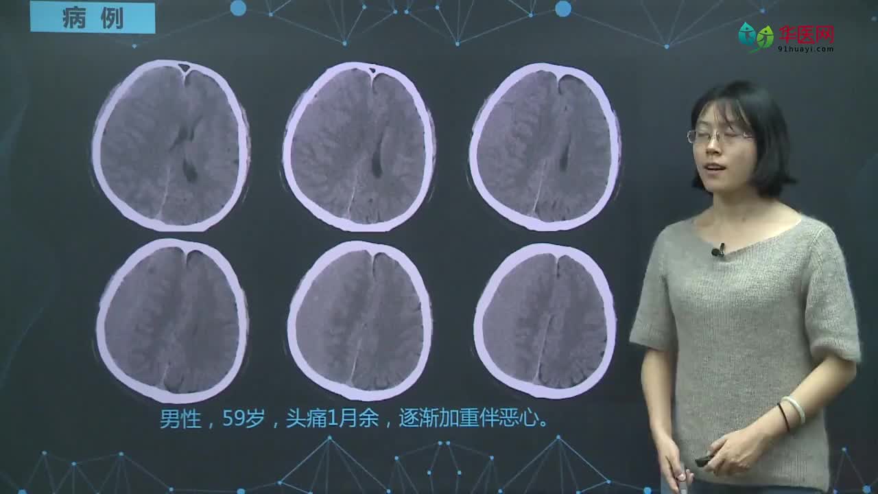 脑出血影像学表现（下）