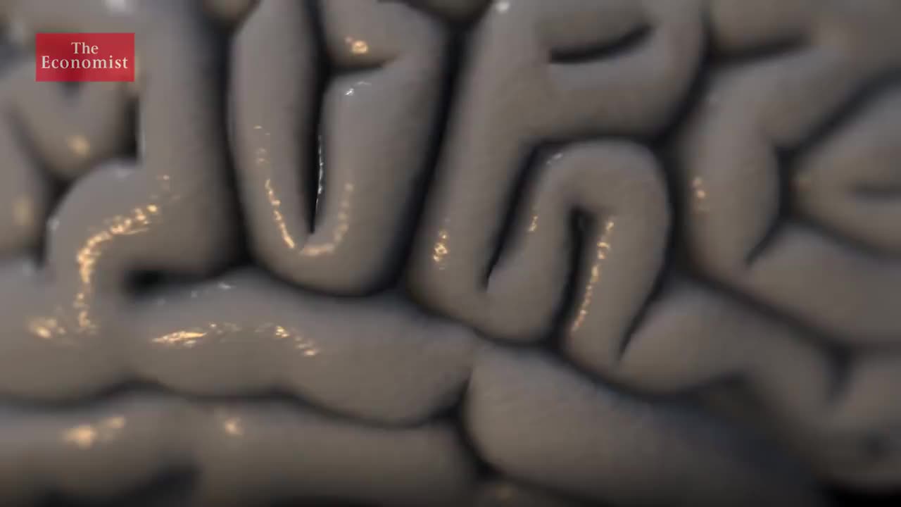 【2019.5.7】231. Why is Alzheimer's still a medical mystery_