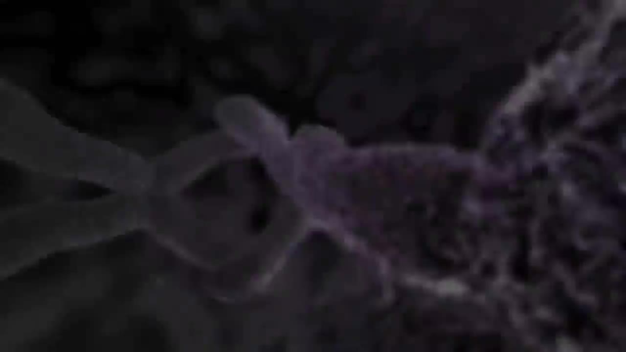 脑震荡创伤性脑损伤 40-Concussion Traumatic Brain Injury (TBI)