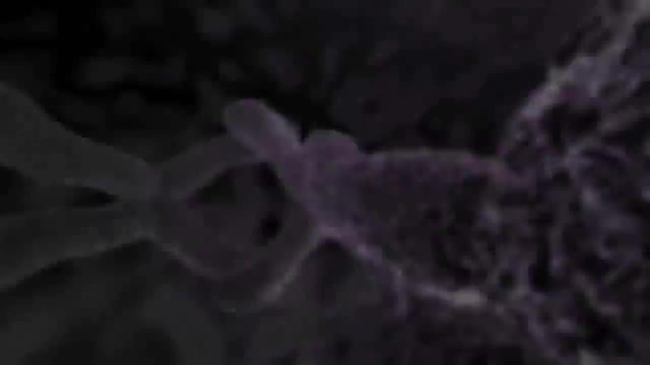 剖腹产 30-Cesariana