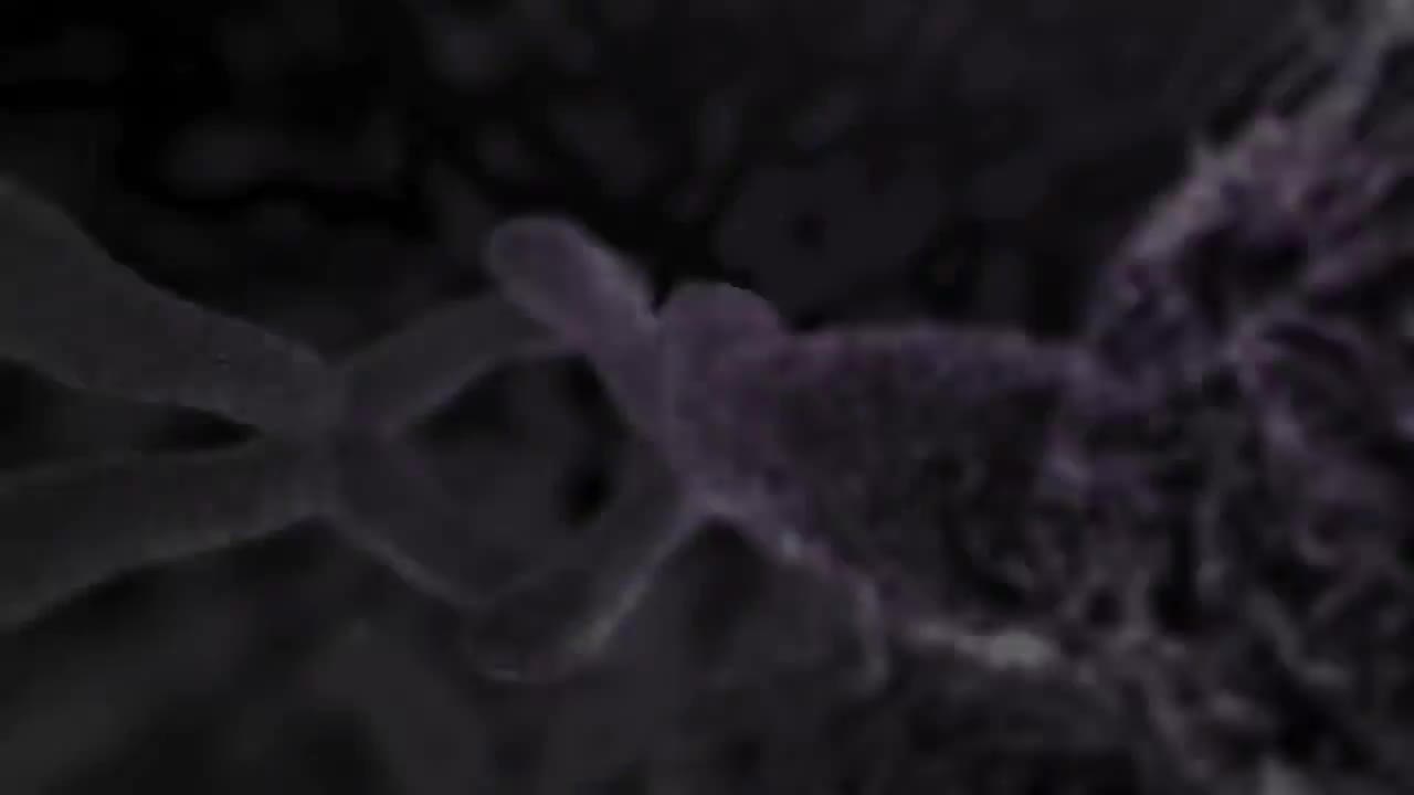 子宫切除术 108-Histerectomía