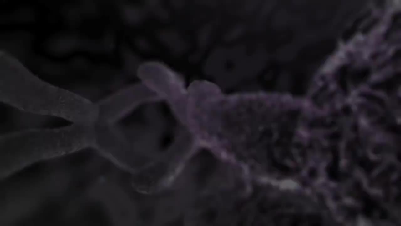 肠道易激综合症 107-Irritable Bowel Syndrome IBS