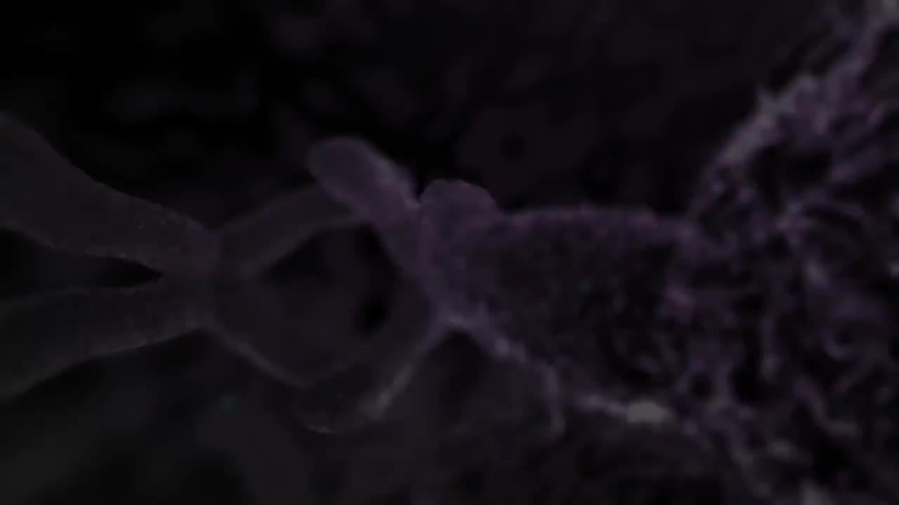 急性冠状动脉综合征与心脏病发作 81-Acute Coronary Syndrome and Heart Attack