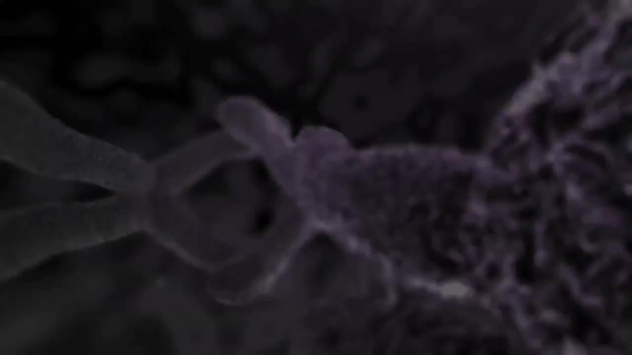 膝关节韧带撕裂 75-Torn ACL Knee Ligament