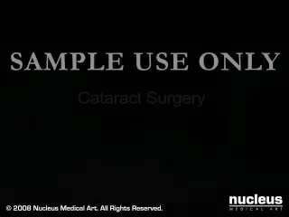 内障外科 66-Cataract Surgery (2009)