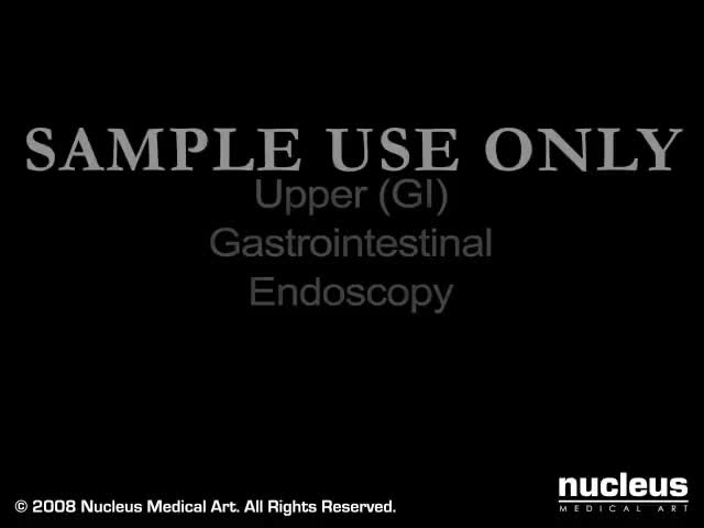 上消化道内窥镜 68-Upper GI Endoscopy Nucleus Health