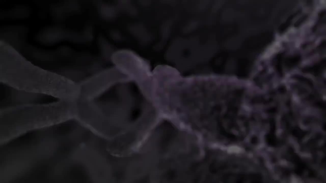 精索静脉曲张修补85-Varicocele Repair