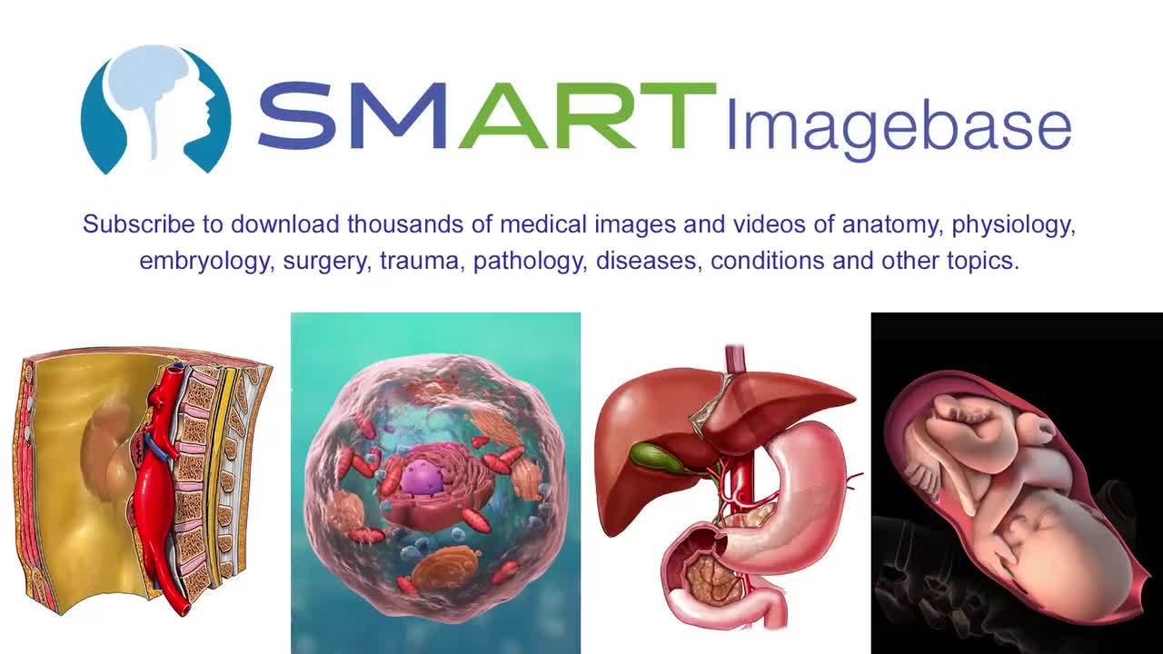 冠状动脉成形术(桡动脉通路) 76-Coronary Artery Angioplasty ( Radial Access)