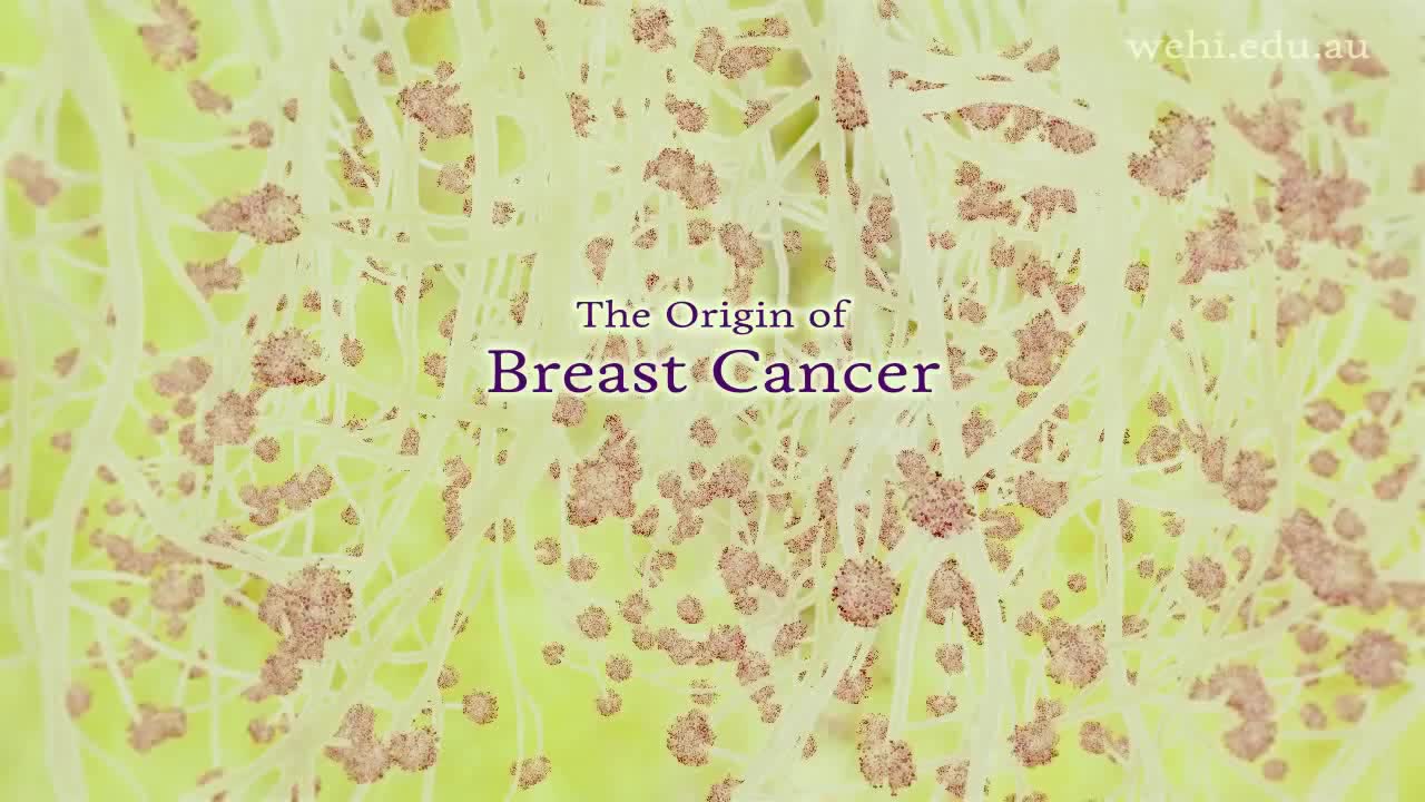 乳腺癌的起源 37-The Origin of Breast Cancer