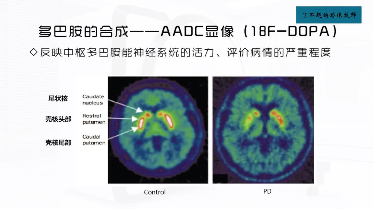 [6.3.1]--7.3 神经递质-受体显像2