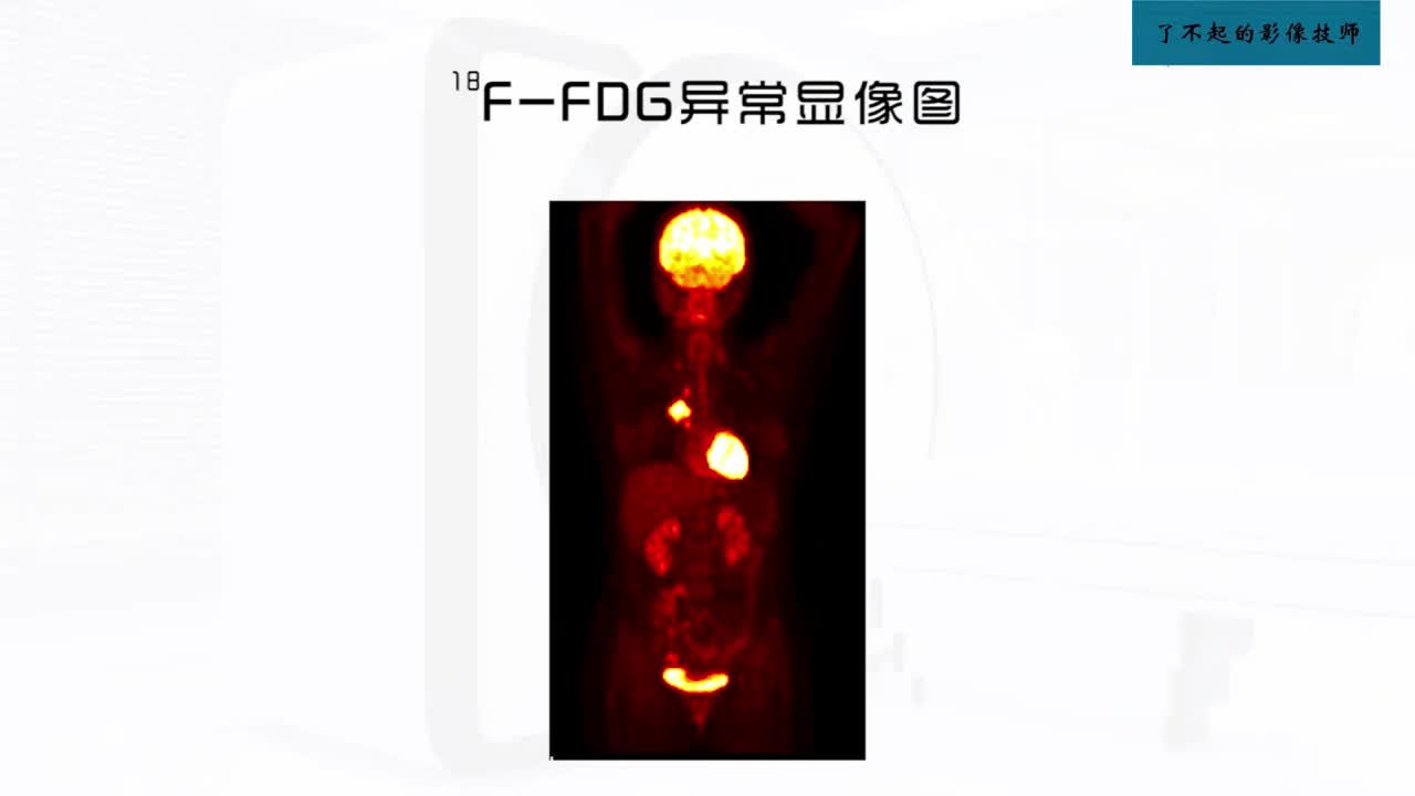 [10.1.1]--10.1 18F-FDG PETCT显像原理及图像分析2