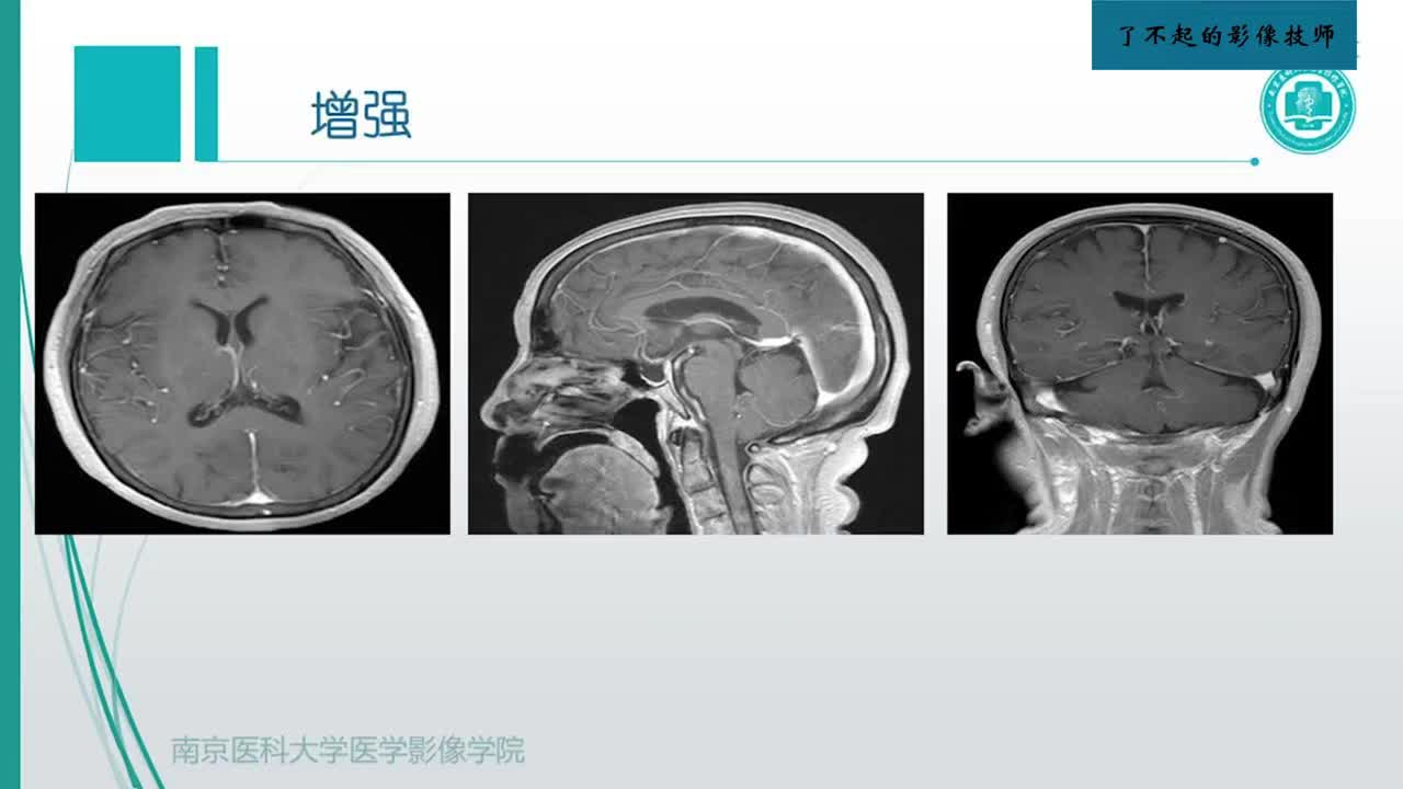 2.1 中枢影像概述5