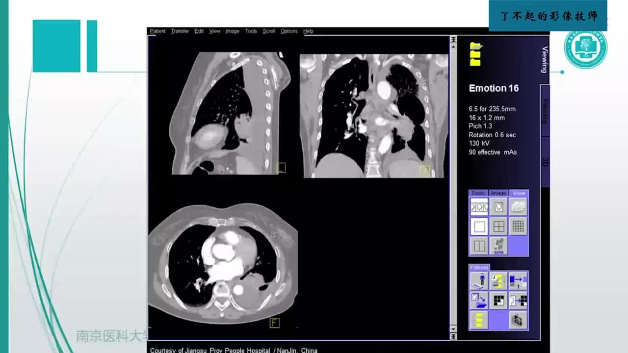 1.2 X线、CT、MR成像（二）1