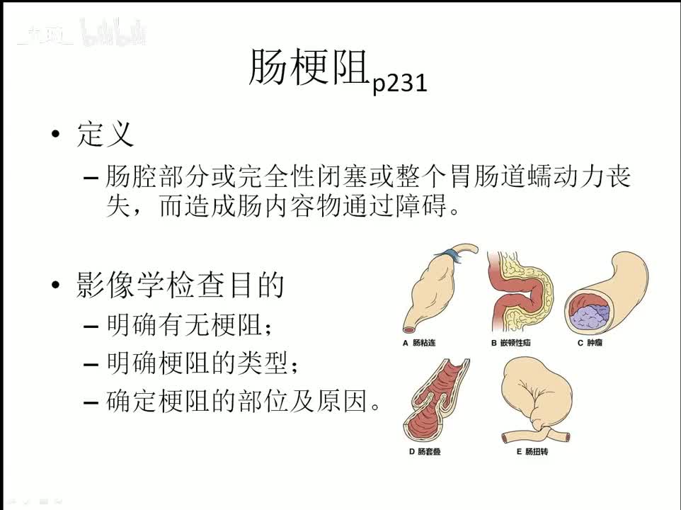 25 消化-5-急腹症及脂肪肝