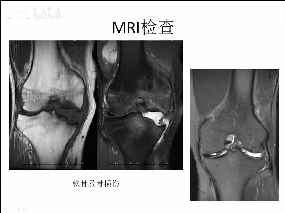 34 骨骼肌系统-2-检查技术2及正常表现