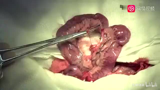 20. 动物手术演示二（狗胃穿孔修补术、狗脾切除术、狗小肠部分切除+端端吻合术）（下）