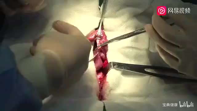 18. 动物手术演示一（麻醉、剖腹术、狗盲肠切除术、关腹术）（下）