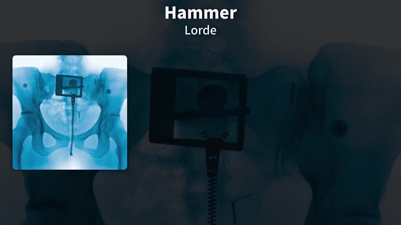 杜比全景声(Dolby Atmos)