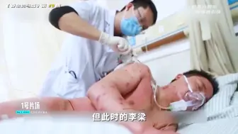 Download Video: 34岁男子被上万只马蜂叮咬，浑身都是针眼，不久噩耗传来