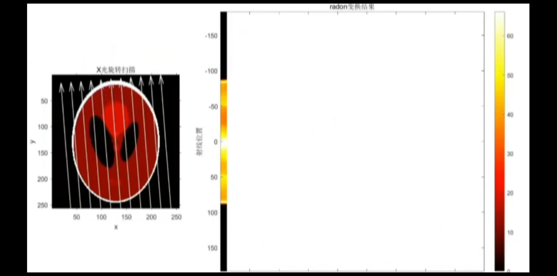 Radon变换示意哔哩哔哩bilibili