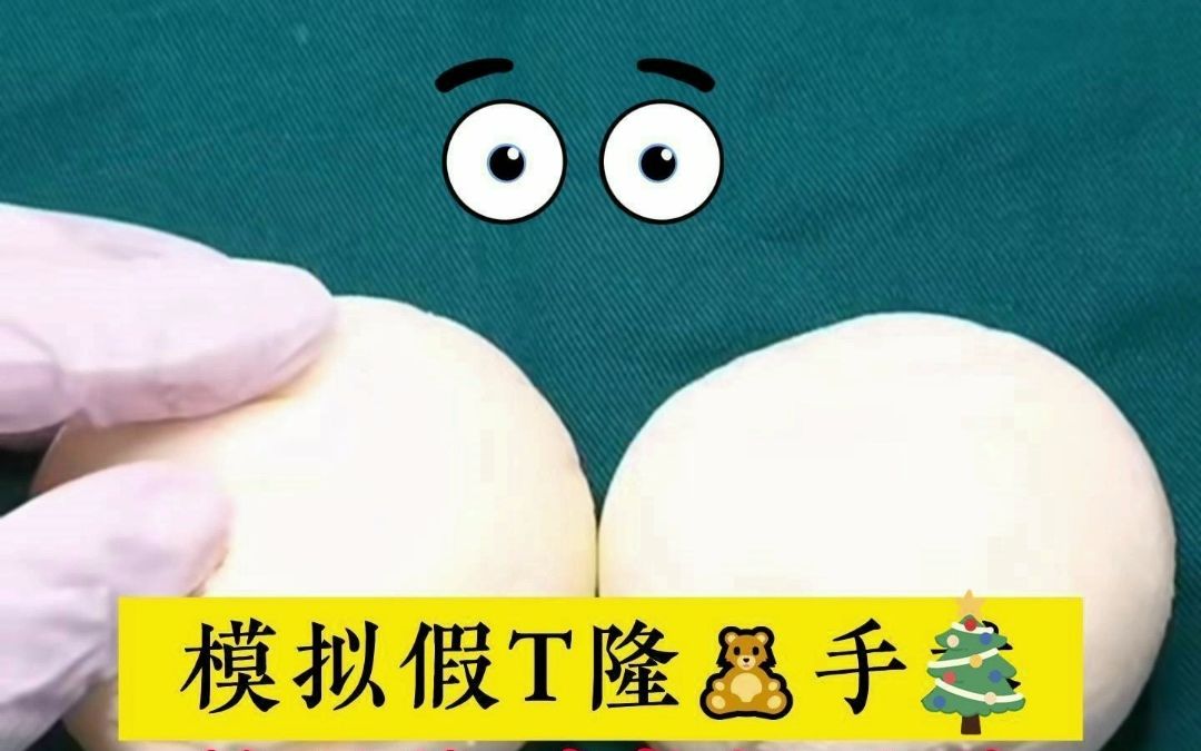 假体隆胸手术过程哔哩哔哩bilibili