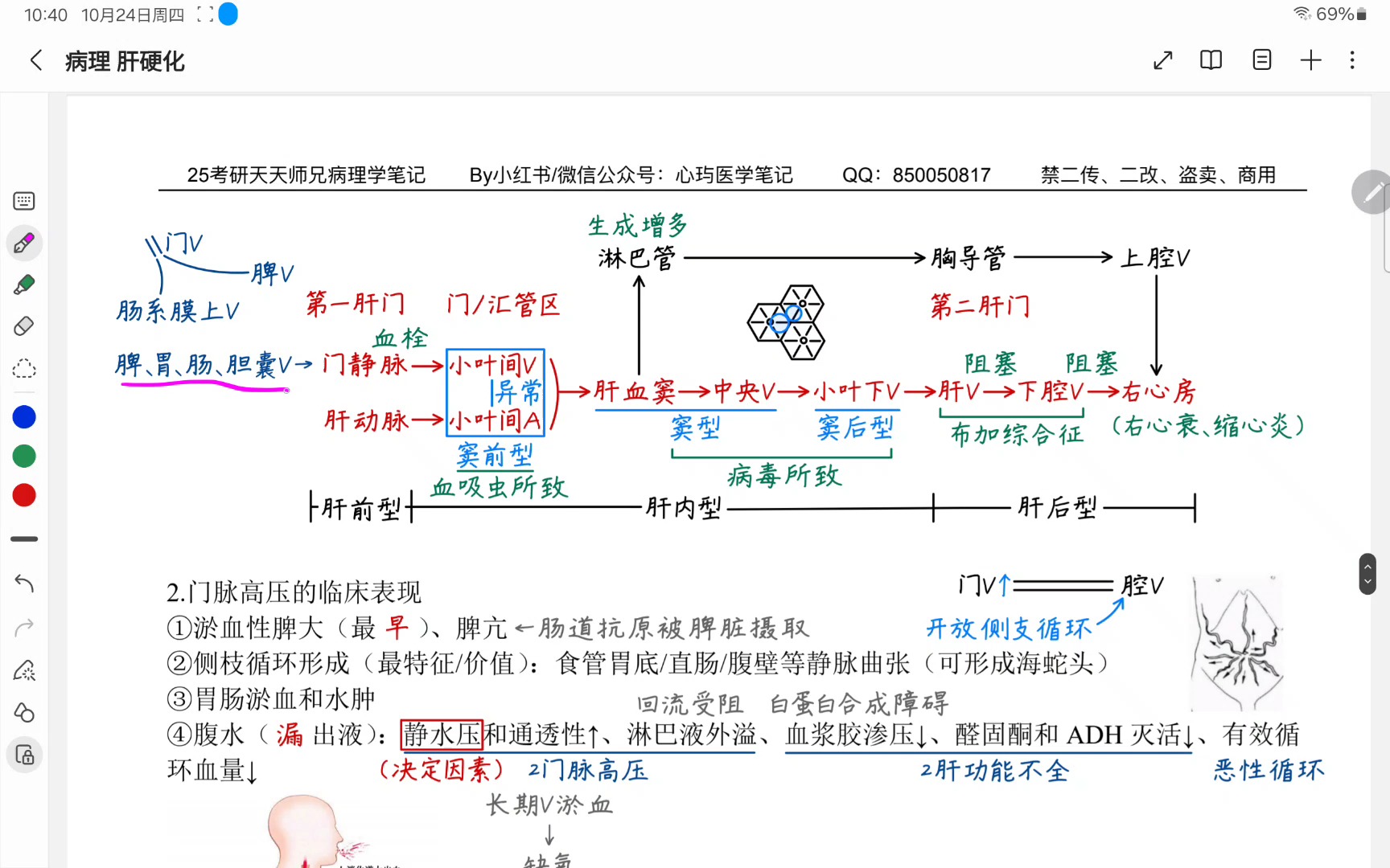 肝硬化发病机制图图片