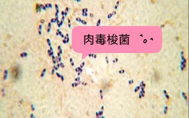 医学微生物——肉毒梭菌 艰难梭菌 无芽孢厌氧哔哩哔哩bilibili