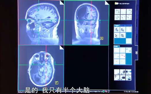 【纪录片】神奇的大脑(中英文全2集)哔哩哔哩bilibili