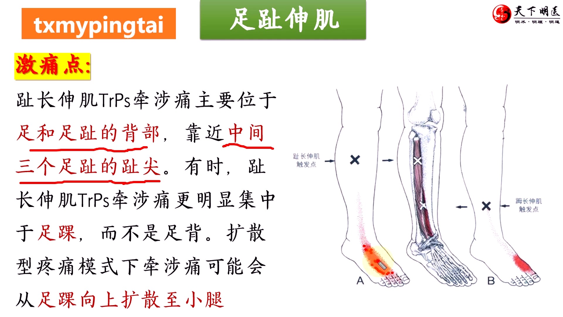 【足趾伸肌】3d解剖