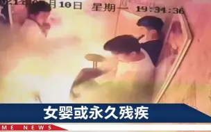 下载视频: 成都一电梯内电瓶车爆燃致女婴烧伤，父亲：她只剩2个完整手指