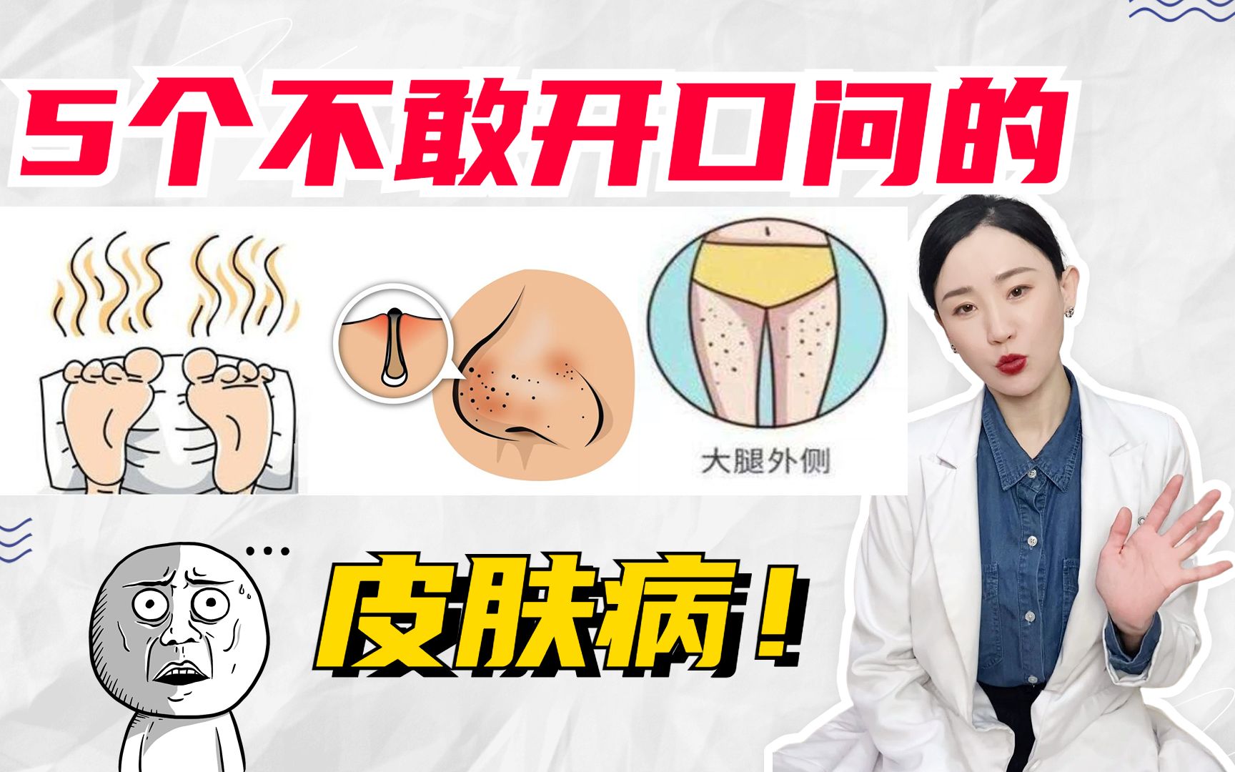 5个不敢开口问的皮肤病!皮肤科医生教你一招!哔哩哔哩bilibili