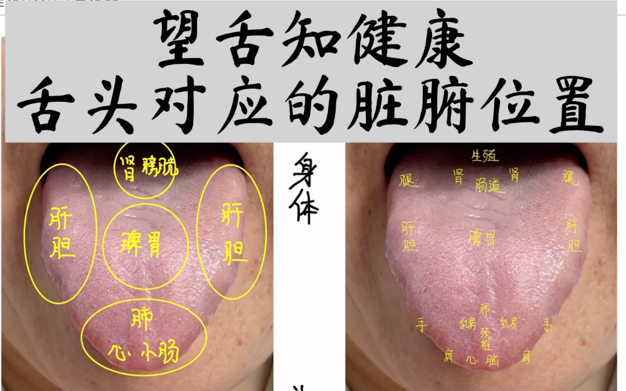 [图]人人都学得会的舌诊（第一讲）：望舌知健康-做自己和家人合格的体检医生