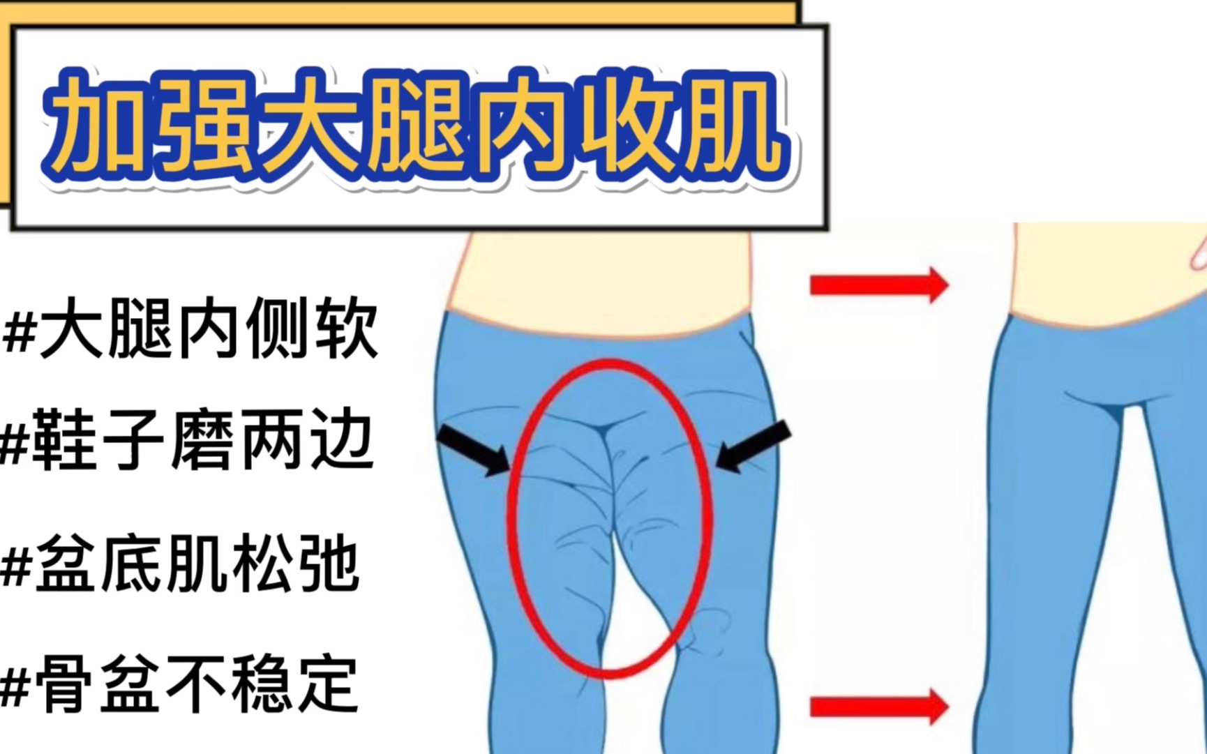 4组简单动作有效消除大腿内侧赘肉穿啥裤子都显瘦