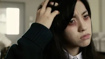 女孩总觉得后脑勺有点痒 扒开头发一看 闺蜜当场就吐了《腐败》
